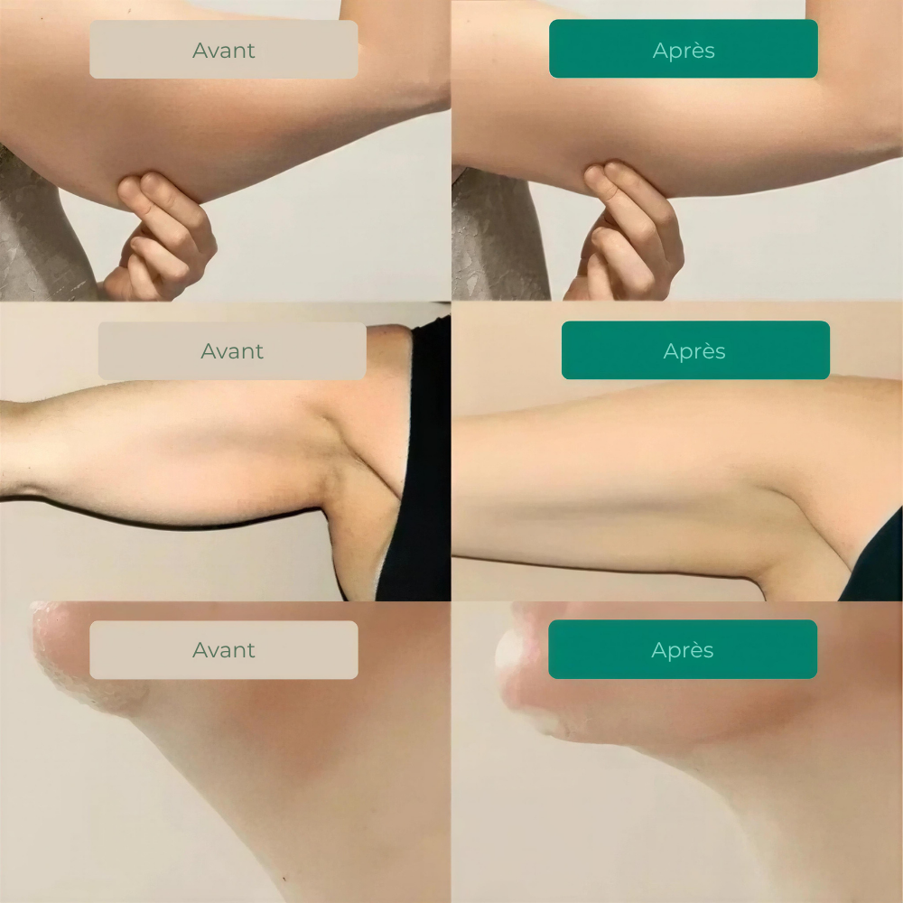Embrunes – Drenante Linfatico