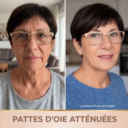 Pattes d'oie atténuées