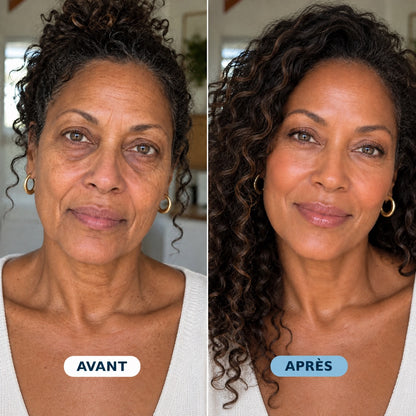 Avant / après